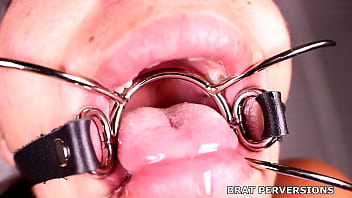 Close-up View Of A Mouth Gag – Bratty Kinks